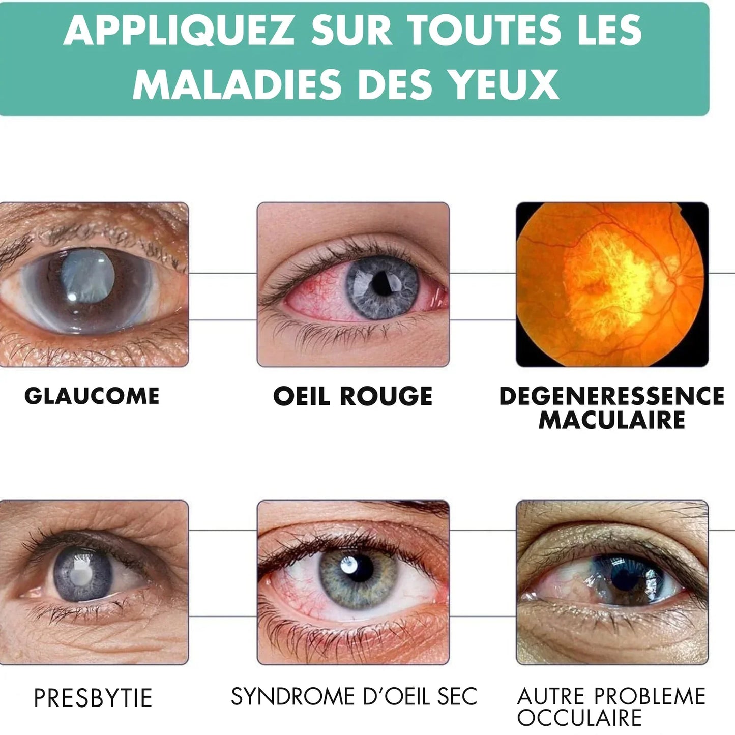 Rouleau Réparateur Vision – Soulage & Améliore la Vue Naturellement