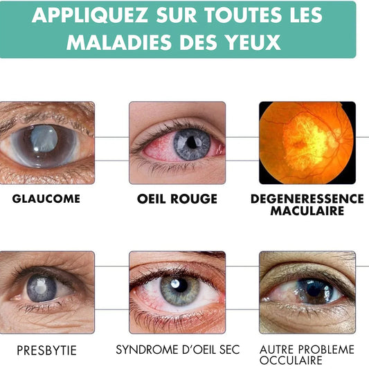 Rouleau Réparateur Vision – Soulage & Améliore la Vue Naturellement